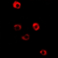 TPM3 Antibody - Immunofluorescent analysis of Tropomyosin 3 staining in HeLa cells. Formalin-fixed cells were permeabilized with 0.1% Triton X-100 in TBS for 5-10 minutes and blocked with 3% BSA-PBS for 30 minutes at room temperature. Cells were probed with the primary antibody in 3% BSA-PBS and incubated overnight at 4 deg C in a humidified chamber. Cells were washed with PBST and incubated with a DyLight 594-conjugated secondary antibody (red) in PBS at room temperature in the dark.