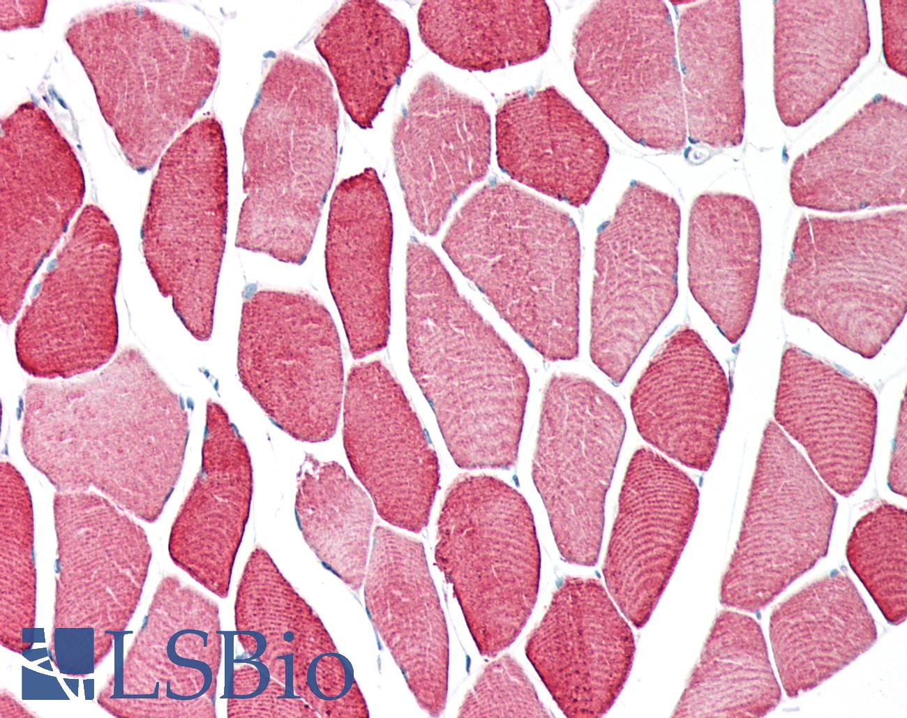 TPM3 Antibody - Human Skeletal Muscle: Formalin-Fixed, Paraffin-Embedded (FFPE)