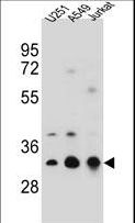 TPM4 Antibody - TPM4 Antibody western blot of U251,A549,Jurkat cell line lysates (35 ug/lane). The TPM4 antibody detected the TPM4 protein (arrow).