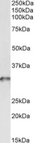 TPM4 Antibody - TPM4 antibody (0.03 ug/ml) staining of Human Platelets lysate (35 ug protein in RIPA buffer). Primary incubation was 1 hour. Detected by chemiluminescence.