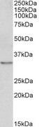 TPM4 Antibody - Tropomyosin 4 / TPM4 antibody (0.1µg/ml) staining of NIH3T3 lysate (35µg protein in RIPA buffer). Detected by chemiluminescence.