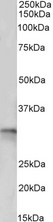 TPM4 Antibody - Tropomyosin 4 / TPM4 antibody (0.5µg/ml) staining of Pig Heart lysate (35µg protein in RIPA buffer). Detected by chemiluminescence.
