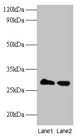 TPMT Antibody - Western blot All lanes: Thiopurine S-methyltransferase antibody at 2µg/ml Lane 1: EC109 whole cell lysate Lane 2: 293T whole cell lysate Secondary Goat polyclonal to rabbit IgG at 1/15000 dilution Predicted band size: 27 kDa Observed band size: 27 kDa