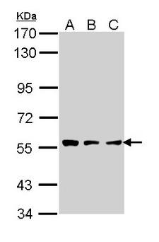 TPP1 / CLN2 Antibody - Sample (30 ug of whole cell lysate). A: A431 , B: H1299, C: Hela. 7.5% SDS PAGE. TPP1 antibody diluted at 1:1000.