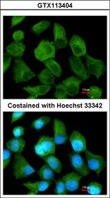 TPP1 / CLN2 Antibody - Immunofluorescence of methanol-fixed A431 using TPP1 antibody at 1:200 dilution.