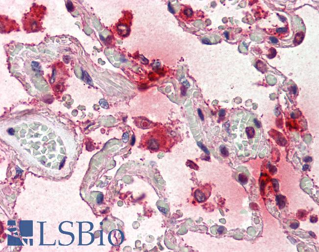 TPSAB1 / Mast Cell Tryptase Antibody - Anti-TPSAB1 / Mast Cell Tryptase antibody IHC of human lung. Immunohistochemistry of formalin-fixed, paraffin-embedded tissue after heat-induced antigen retrieval. Antibody concentration 5 ug/ml.