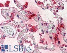 TPSAB1 / Mast Cell Tryptase Antibody - Anti-TPSAB1 / Mast Cell Tryptase antibody IHC of human lung. Immunohistochemistry of formalin-fixed, paraffin-embedded tissue after heat-induced antigen retrieval. Antibody concentration 5 ug/ml.
