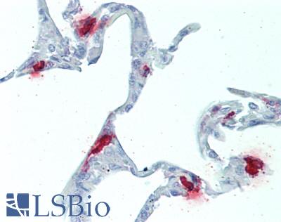 Tpsb2 / Tryptase Beta 2 (Mouse Antibody - Human Lung: Formalin-Fixed, Paraffin-Embedded (FFPE), at a concentration of 10 ug/ml. 