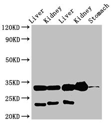 Tpsb2 / Tryptase Beta 2 (Mouse Antibody - Western Blot Positive WB detected in: Rat liver tissue, Rat kidney tissue, Mouse liver tissue, Mouse kidney tissue, Mouse stomach tissue All lanes: TPSB2 antibody at 3µg/ml Secondary Goat polyclonal to rabbit IgG at 1/50000 dilution Predicted band size: 31 kDa Observed band size: 31 kDa