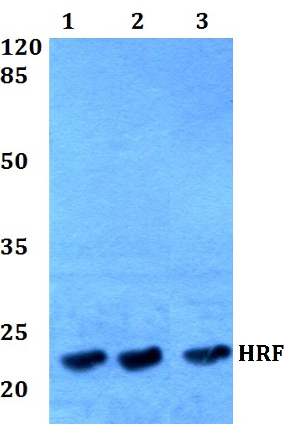 TPT1 / TCTP Antibody - Western blot analysis of Anti-TCTP Antibody at 1:500 dilution.  Lane1: HEK293T whole cell lysate. Lane2: sp2/0 whole cell lysate. Lane3: H9C2 whole cell lysate