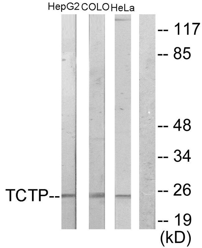 TPT1 / TCTP Antibody - Western blot analysis of lysates from HepG2 and COLO205/HeLa cells, using TCTP Antibody. The lane on the right is blocked with the synthesized peptide.