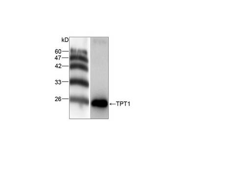 TPT1 / TCTP Antibody