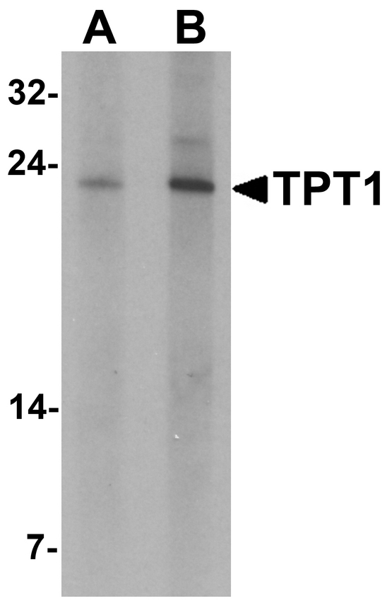 TPT1 / TCTP Antibody - Western blot analysis of TPT1 in human brain tissue lysate with TPT1 antibody at (A) 0.5 and (B) 1 ug/ml.