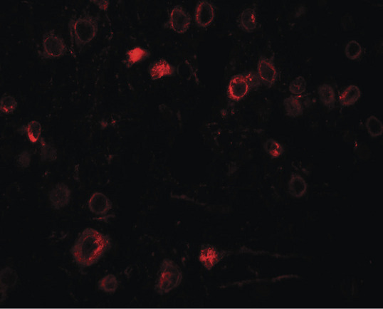 TPT1 / TCTP Antibody - Immunofluorescence of TPT1 in rat brain tissue with TPT1 antibody at 20 ug/ml.