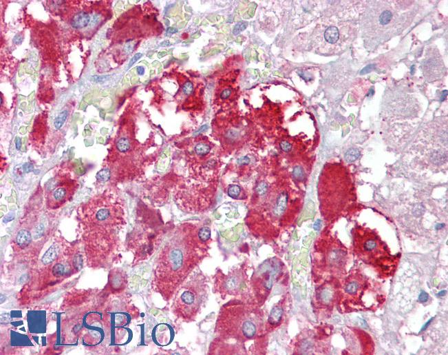 TPTE Antibody - Anti-TPTE antibody IHC of human adrenal. Immunohistochemistry of formalin-fixed, paraffin-embedded tissue after heat-induced antigen retrieval. Antibody concentration 2.5 ug/ml.