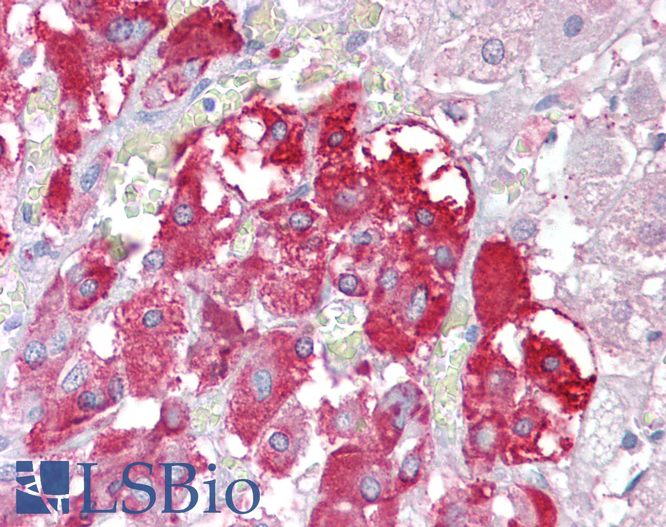 TPTE Antibody - Anti-TPTE antibody IHC of human adrenal. Immunohistochemistry of formalin-fixed, paraffin-embedded tissue after heat-induced antigen retrieval. Antibody concentration 2.5 ug/ml.