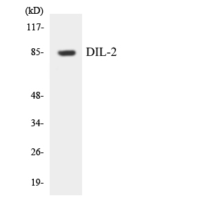 TPX2 Antibody - Western blot analysis of the lysates from HUVECcells using DIL-2 antibody.