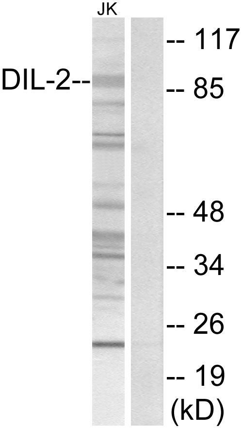 TPX2 Antibody - Western blot analysis of lysates from Jurkat cells, using DIL-2 Antibody. The lane on the right is blocked with the synthesized peptide.