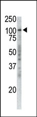 TPX2 Antibody - Western of extracts from Jurkat cells using P100 antibody.