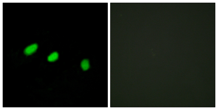 TRA2A Antibody - Immunofluorescence analysis of HeLa cells, using TRA-2 alpha Antibody. The picture on the right is blocked with the synthesized peptide.