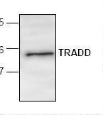 TRADD Antibody - Western blot of TRADD antibody.