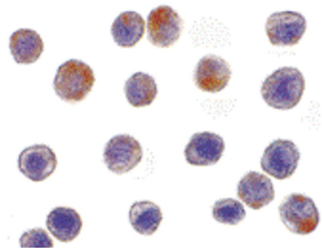 TRAF3 Antibody - Immunocytochemistry of TRAF3 in HeLa cells with TRAF3 antibody at 10 ug/ml.