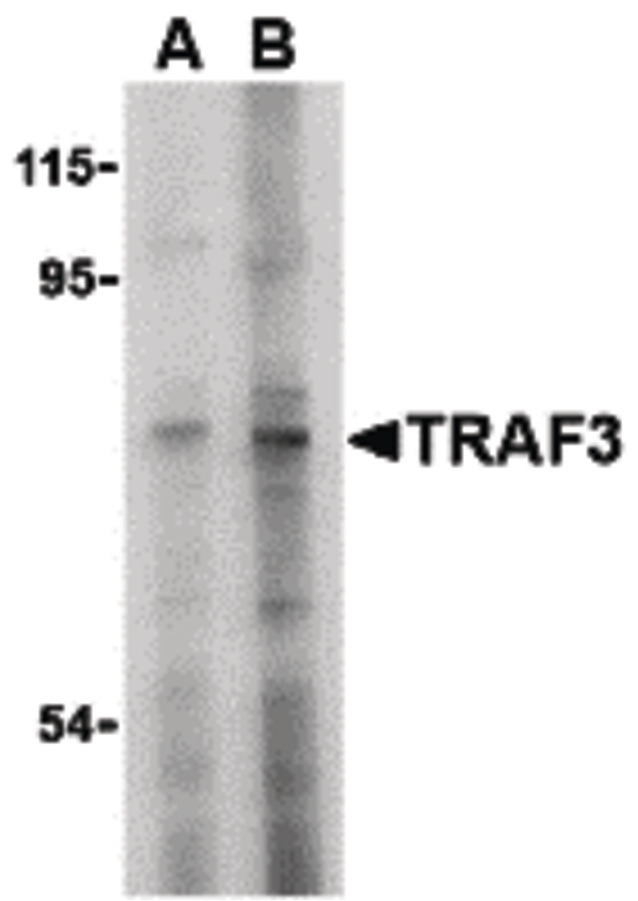 TRAF3 Antibody - Western blot of TRAF3 in HeLa cell lysate with TRAF3 antibody at (A) 2 and (B) 4 ug/ml.