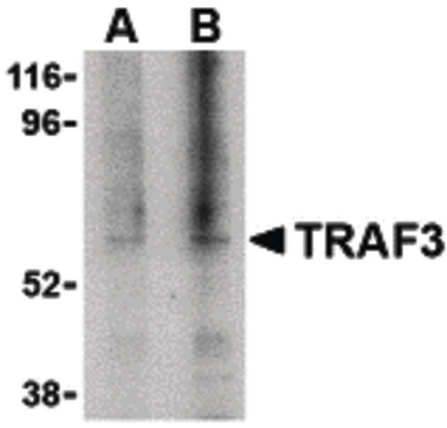 TRAF3 Antibody - Western blot of TRAF3 in 3T3 cell lysate with TRAF3 antibody at (A) 1, and (B) 2 ug/ml.