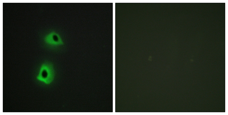 TRAF3IP3 Antibody - Immunofluorescence analysis of HeLa cells, using T3JAM Antibody. The picture on the right is blocked with the synthesized peptide.