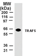TRAF5 Antibody - Western blot of TRAF5 using antibody at 2 ug/ml dilution against 10 ug of HeLa cell lysate.