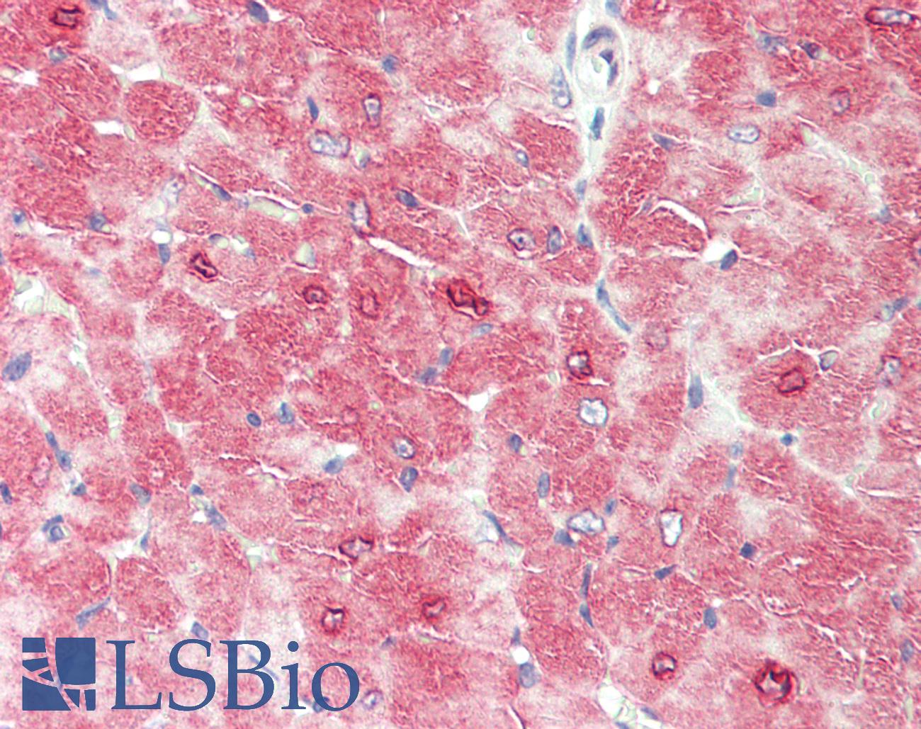 TRAF6 Antibody - Mouse Heart: Formalin-Fixed, Paraffin-Embedded (FFPE)