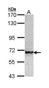TRAF6 Antibody - Sample (30 ug of whole cell lysate). A: Hep G2. 7.5% SDS PAGE. TRAF6 antibody diluted at 1:1000. 