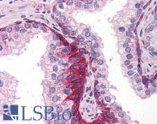 TRAF6 Antibody - Anti-TRAF6 antibody IHC of human prostate. Immunohistochemistry of formalin-fixed, paraffin-embedded tissue after heat-induced antigen retrieval. Antibody concentration 10 ug/ml.