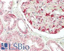 transmembrane channel-like 1 Antibody - Human Kidney: Formalin-Fixed, Paraffin-Embedded (FFPE)