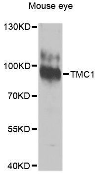 transmembrane channel-like 1 Antibody - Western blot analysis of extracts of Mouse eye cells, using TMC1 antibody.