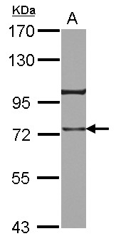 TRAP1 / HSP75 Antibody - Sample (30 ug of whole cell lysate) A: A431 7.5% SDS PAGE TRAP1 antibody diluted at 1:3000