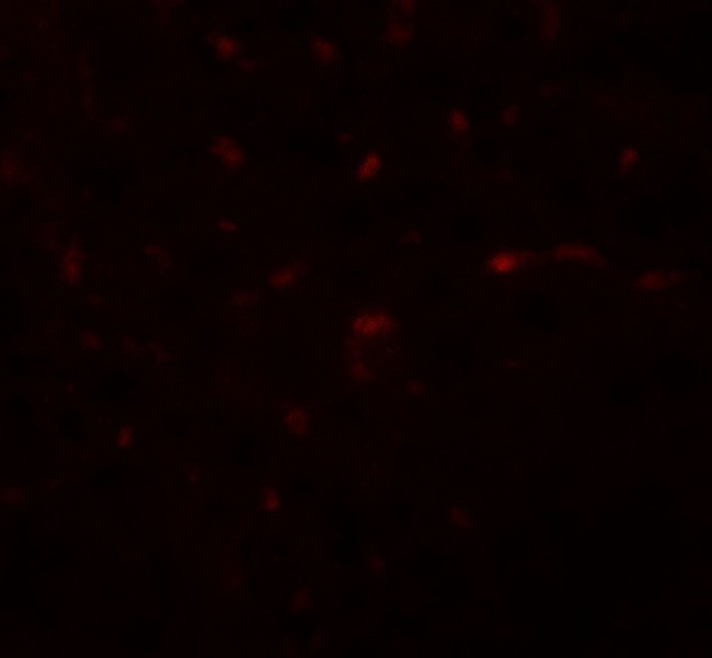 TRB3 / TRIB3 Antibody - Immunofluorescence of TRB3 in mouse liver tissue with TRB3 antibody at 20 ug/mL.