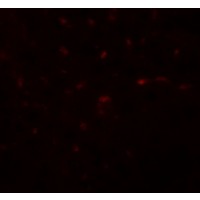 TRB3 / TRIB3 Antibody - Immunofluorescence of TRB3 in mouse liver tissue with TRB3 antibody at 20 µg/mL.