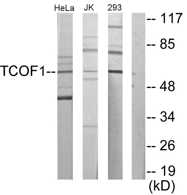 Treacle / TCOF1 Antibody - Western blot analysis of lysates from Jurkat, 293, HeLa cells, using TCOF1 Antibody. The lane on the right is blocked with the synthesized peptide.