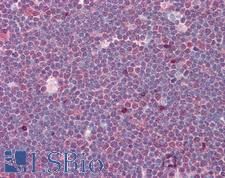 Treacle / TCOF1 Antibody - Anti-Treacle / TCOF1 antibody IHC of human thymus. Immunohistochemistry of formalin-fixed, paraffin-embedded tissue after heat-induced antigen retrieval. Antibody dilution 5 ug/ml.