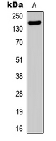Treacle / TCOF1 Antibody - Western blot analysis of TCOF1 expression in HEK293T (A) whole cell lysates.
