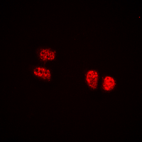 Treacle / TCOF1 Antibody - Immunofluorescent analysis of TCOF1 staining in HEK293T cells. Formalin-fixed cells were permeabilized with 0.1% Triton X-100 in TBS for 5-10 minutes and blocked with 3% BSA-PBS for 30 minutes at room temperature. Cells were probed with the primary antibody in 3% BSA-PBS and incubated overnight at 4 deg C in a humidified chamber. Cells were washed with PBST and incubated with a DyLight 594-conjugated secondary antibody (red) in PBS at room temperature in the dark. DAPI was used to stain the cell nuclei (blue).