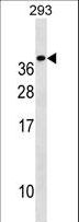 TREM1 Antibody - TREM1 Antibody western blot of 293 cell line lysates (35 ug/lane). The TREM1 antibody detected the TREM1 protein (arrow).