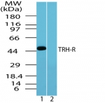 TRH Receptor / TRHR Antibody - Western blot of human TRH-R in human brain lysate in the 1) absence and 2) presence of immunizing peptide using antibody at 0.5 ug/ml.