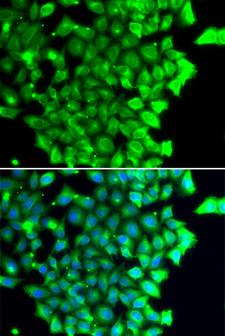 TRIAP1 Antibody - Immunofluorescence analysis of MCF7 cell using TRIAP1 antibody. Blue: DAPI for nuclear staining.