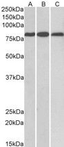 TRIM1 / MID2 Antibody - Goat Anti-MID2 / TRIM1 Antibody (0.1µg/ml) staining of Mouse (A) and Rat (B) Heart, and Rat Kidney (C) lysates (35µg protein in RIPA buffer). Primary incubation was 1 hour. Detected by chemiluminescencence.