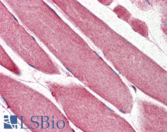 TRIM11 Antibody - Anti-TRIM11 antibody IHC staining of human skeletal muscle. Immunohistochemistry of formalin-fixed, paraffin-embedded tissue after heat-induced antigen retrieval. Antibody concentration 5 ug/ml.