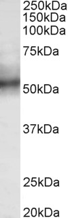 TRIM11 Antibody - TRIM11 antibody (0.3 ug/ml) staining of Human Spleen lysate (35 ug protein in RIPA buffer). Primary incubation was 1 hour. Detected by chemiluminescence.