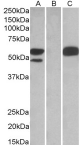 TRIM21 / RO52 Antibody - HEK293 lysate (10ug protein in RIPA buffer) overexpressing Human TRIM21 with C-terminal MYC tag probed with TRIM21 / RO52 antibody (1ug/ml) in Lane A and probed with anti-MYC Tag (1/1000) in lane C. Mock-transfected HEK293 probed with TRIM21 / RO52 antibody (1mg/ml) in Lane B. Detected by chemiluminescence.