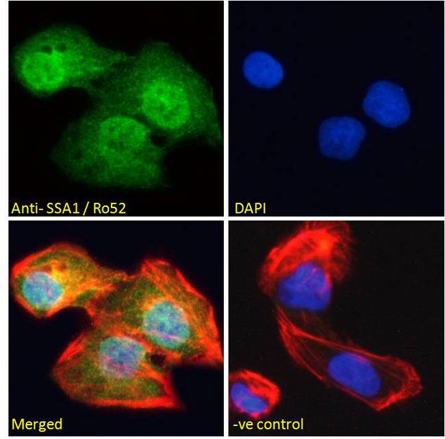 TRIM21 / RO52 Antibody - TRIM21 / RO52 antibody immunofluorescence analysis of paraformaldehyde fixed U2OS cells, permeabilized with 0.15% Triton. Primary incubation 1hr (10ug/ml) followed by Alexa Fluor 488 secondary antibody (2ug/ml), showing strong nuclear and some cytoplasmic staining. Actin filaments were stained with phalloidin (red) and the nuclear stain is DAPI (blue). Negative control: Unimmunized goat IgG (10ug/ml) followed by Alexa Fluor 488 secondary antibody (2ug/ml).